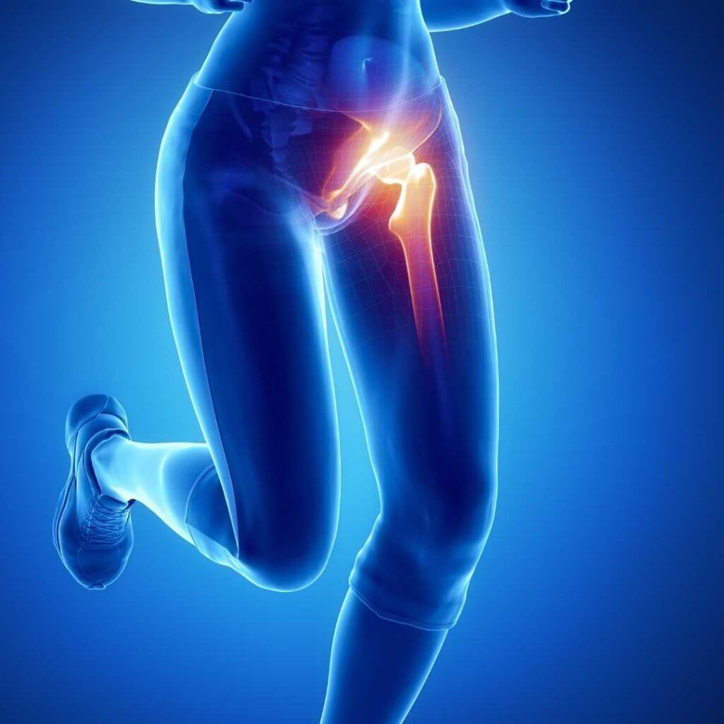 Gelenkblockaden mit stechenden Leistenschmerzen sind oft die Folge eines Labrumschaden. Das Labrum wirkt als Dämpfer bei Belastungen.