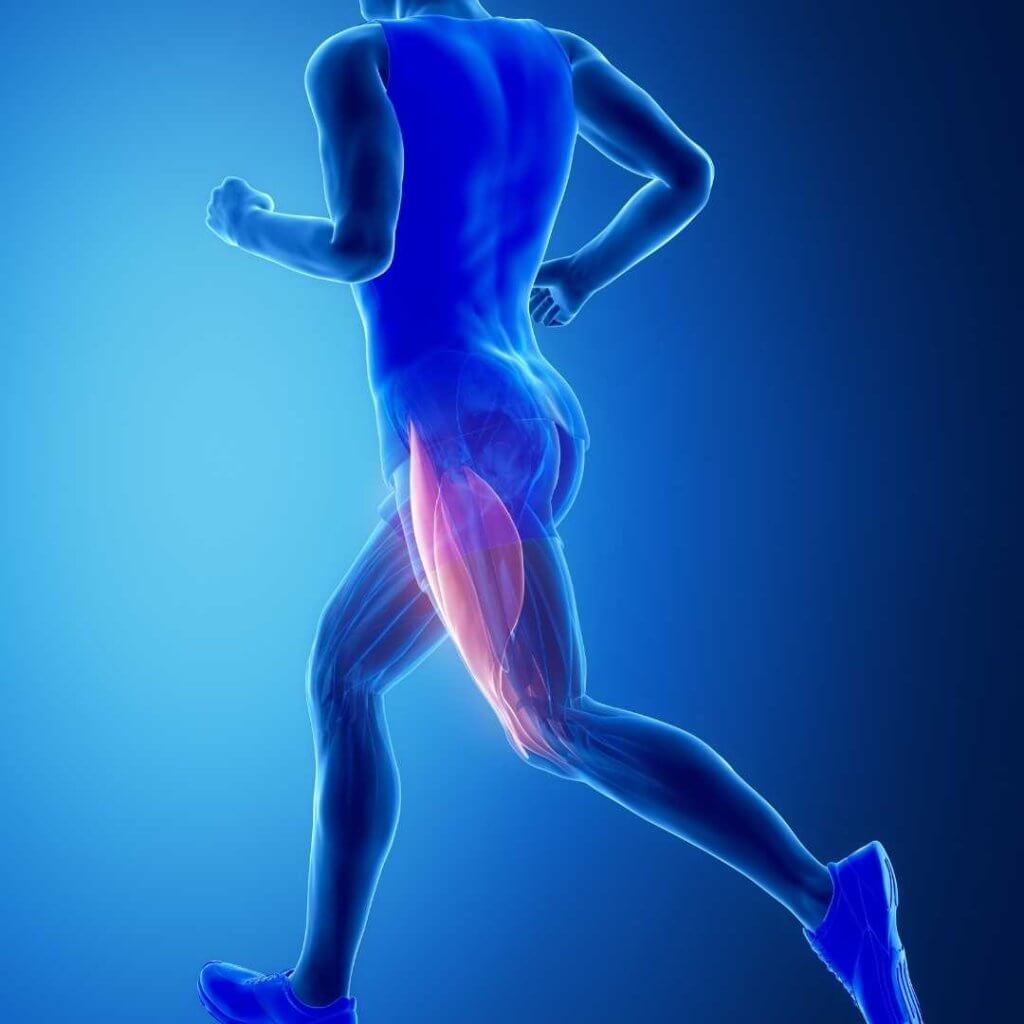 Typischer bei einer Muskelzerrung ist der krampfartige Schmerz im betroffenen Muskel, welcher langsam und kontinuierlich ansteigt.