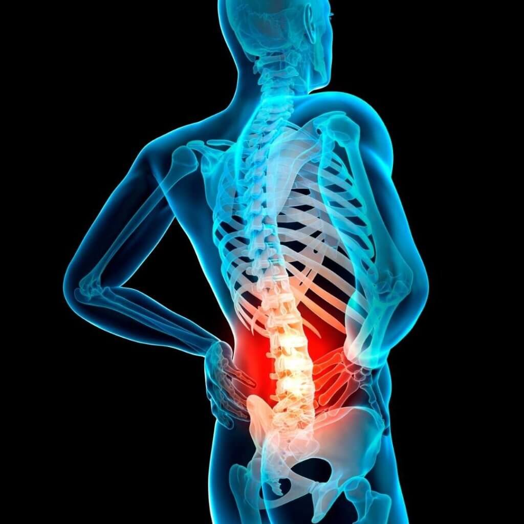 Bei Rückenschmerzen handelt es sich sehr häufig um unspezifische Schmerzen, zu denen keine physiologisch greifbare Ursache gefunden wird.