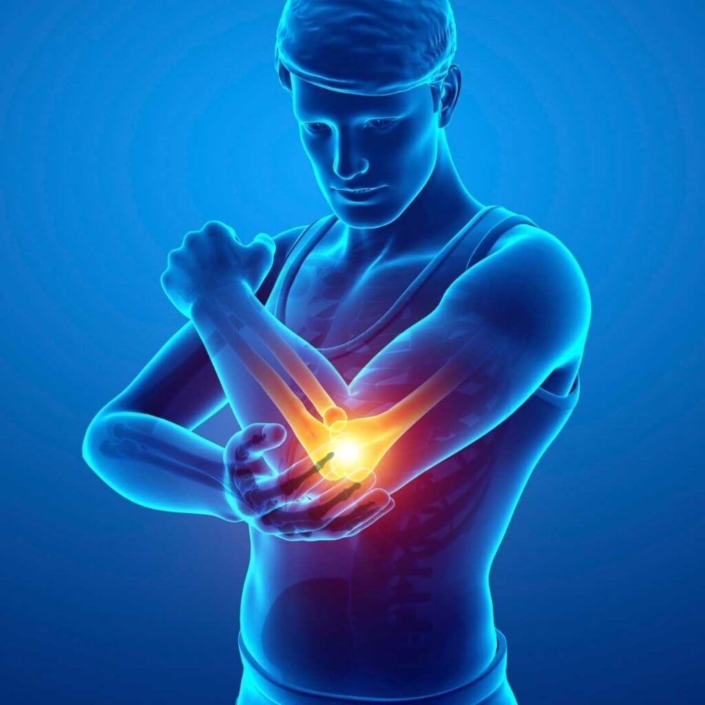 Bei einem Knorpelschaden kann es zu Bewegungs- und Funktionsstörungen im betroffenen Arm kommen und zu Folgeerkrankungen im Ellenbogen führen.